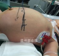 ���峤��λ��ʮ�ֵ��ꡪ���ڸ�Ĥ��