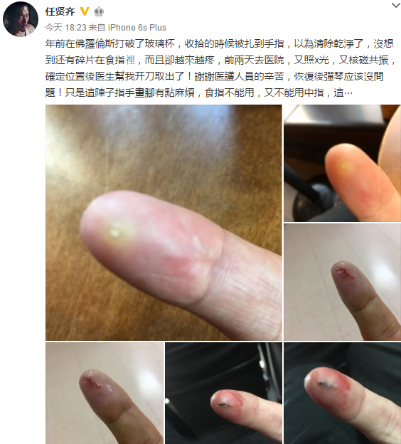 ������������������ָ����� �۵���������