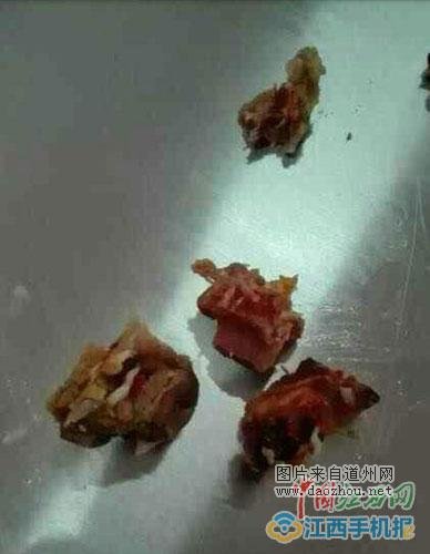 ����һѧУʳ�þ��ֳ���Ѽ�� У��������Ǹ����