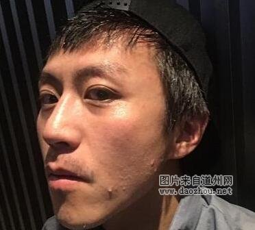 邓超公开瘦身秘诀 15天暴瘦10斤网友调侃下巴能戳死人